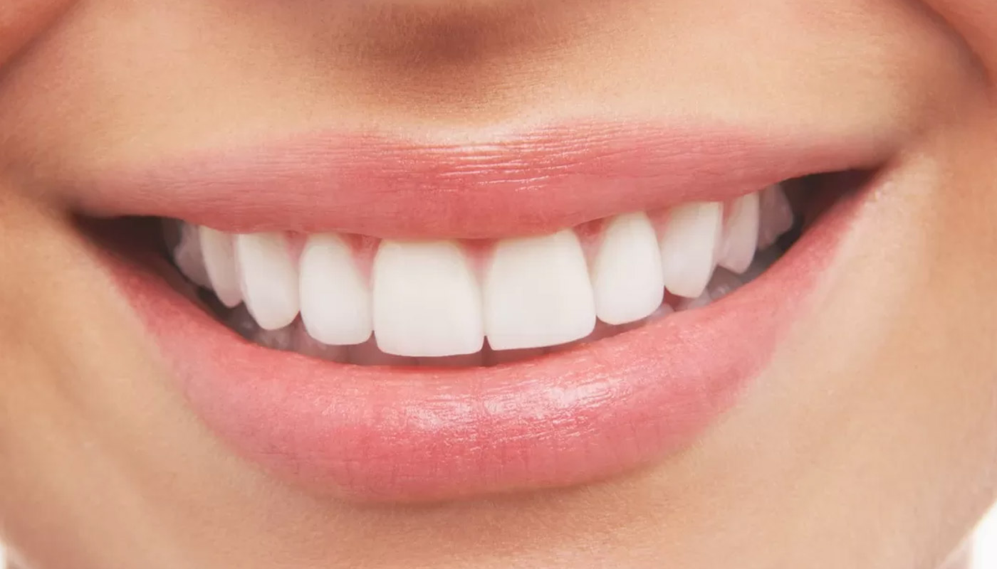 Want Whiter Sparklier Teeth Heres What You Can Do2