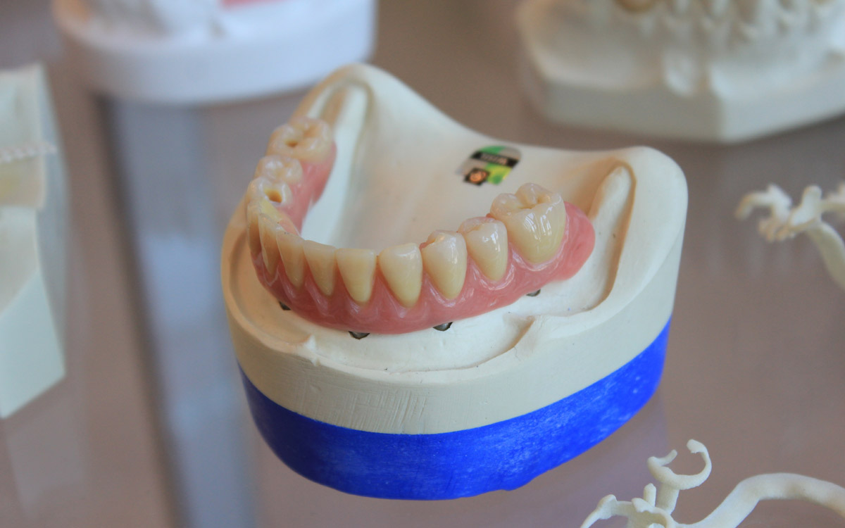 8 Signs You May Have Gum Disease