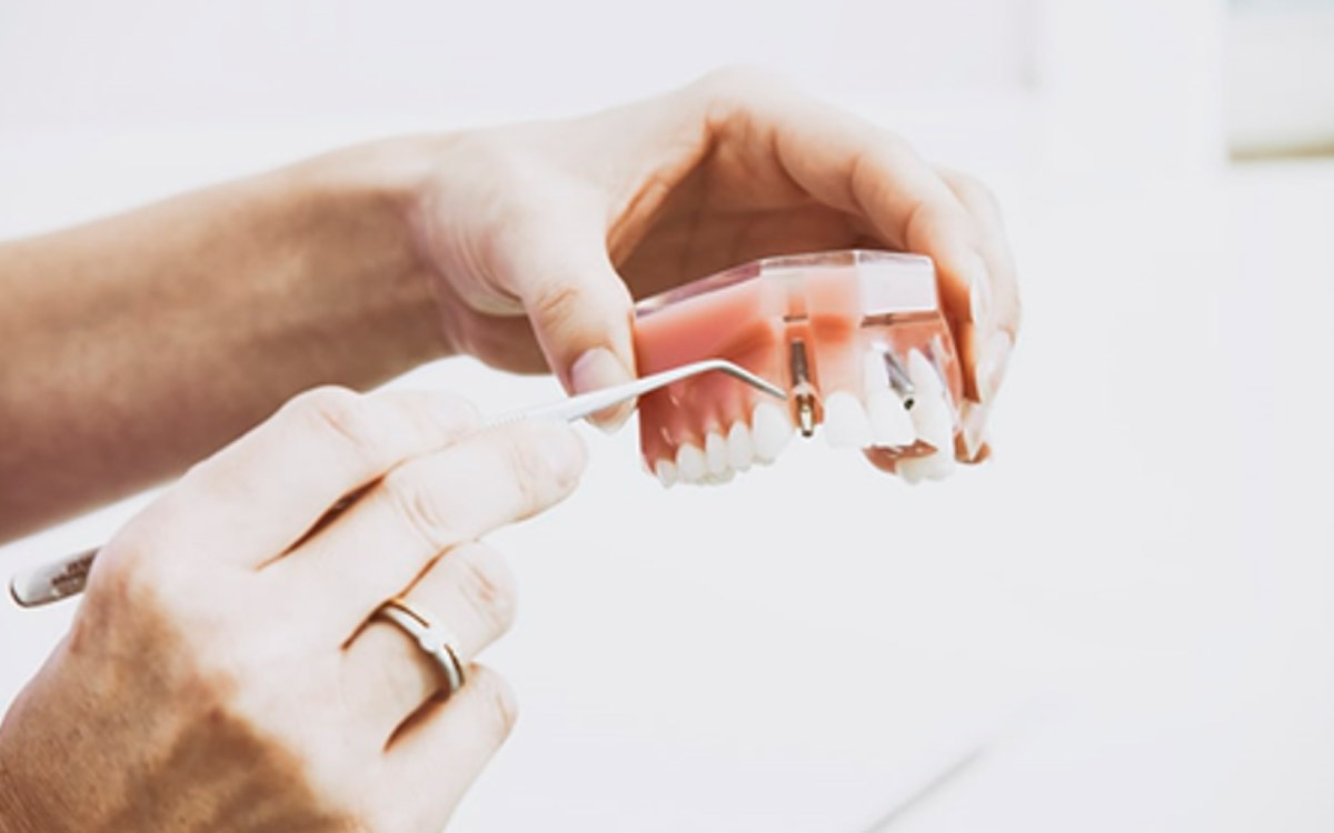 What To Do If Your Dentures Dont Fit