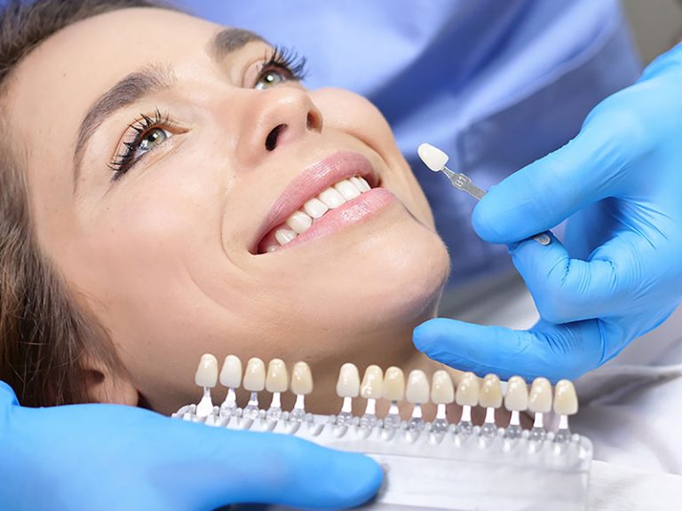 teeth whitening near you