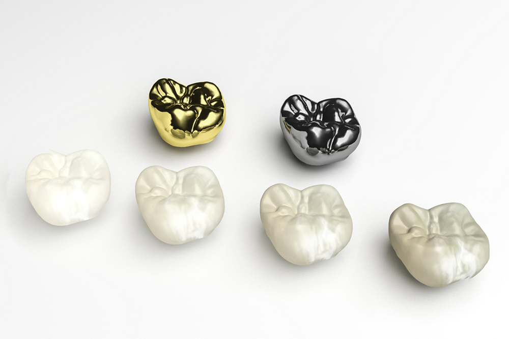 how do dental crowns protect your teeth