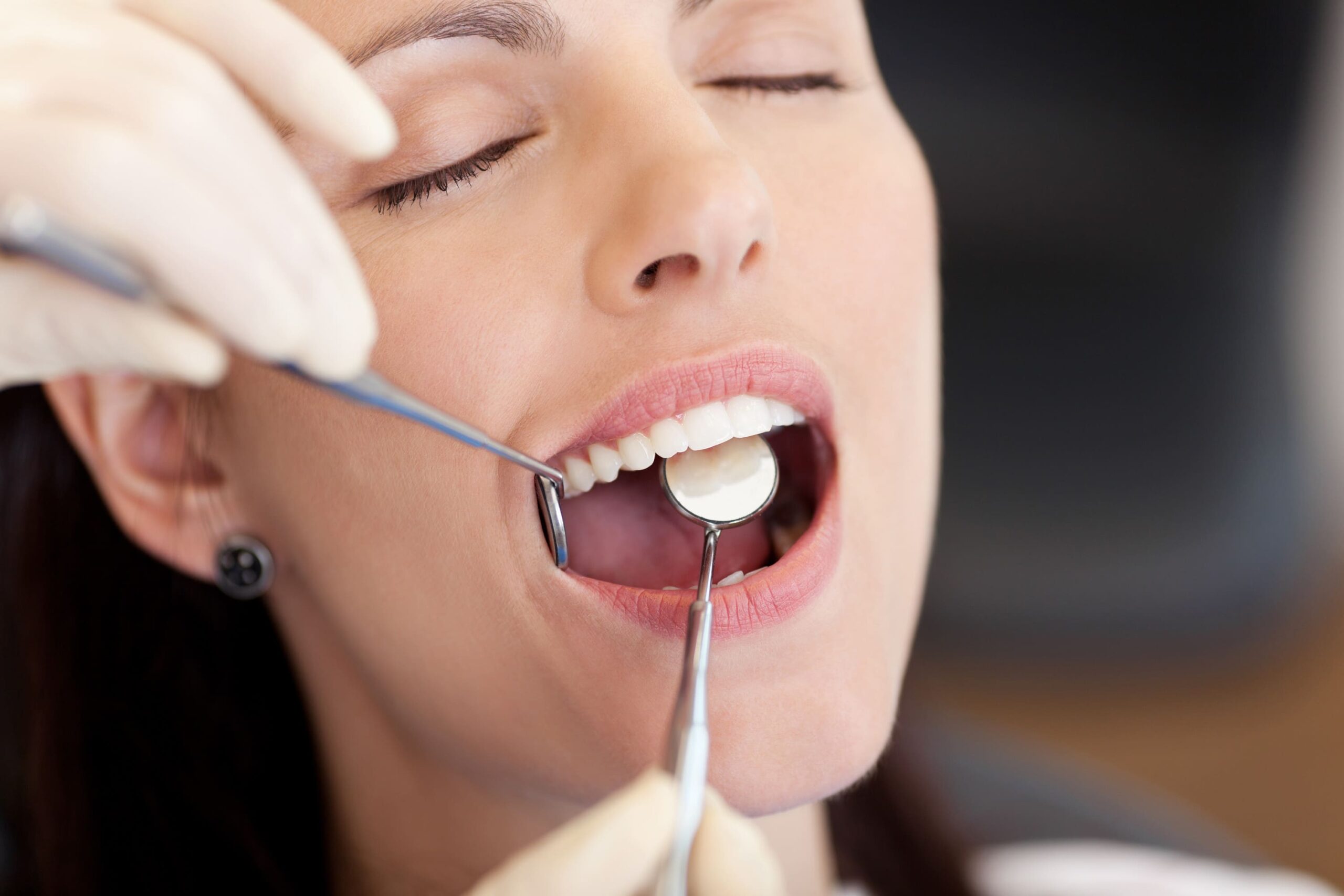 The Most Common Dental Problems and How to Prevent Them (1)
